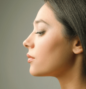  Nasal Polyps | Glendale Plastic Surgery | Burbank | Pasadena