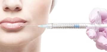 Non-Surgical Lip Enhancement