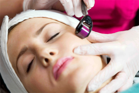 Microneedling Helps Generate New Collagen And Skin Tissue For Smoother, Firmer, More Toned Skin
